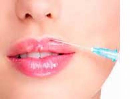 �cido Hialur�nico.